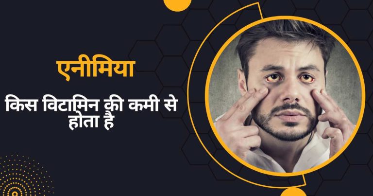एनीमिया किस विटामिन की कमी से होता है