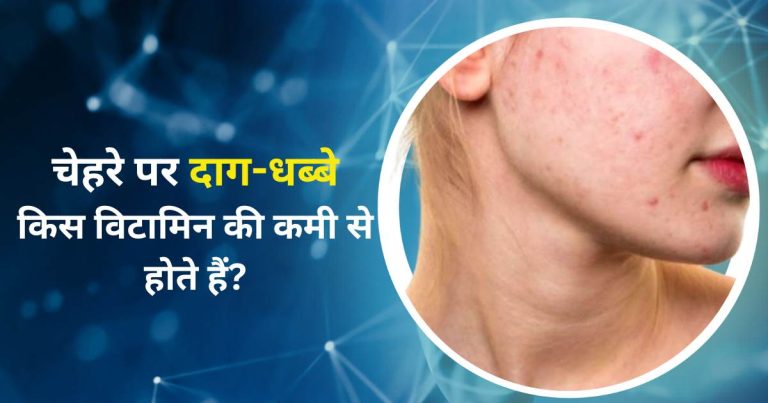 चेहरे पर दाग-धब्बे किस विटामिन की कमी से होते हैं