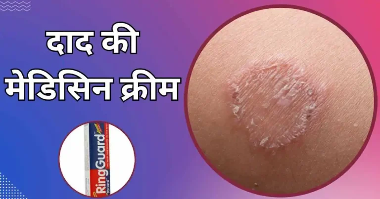 दाद की मेडिसिन क्रीम
