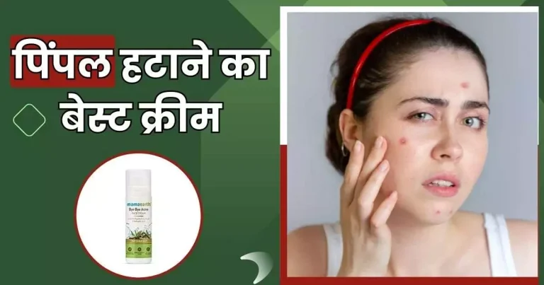 पिंपल हटाने का बेस्ट क्रीम