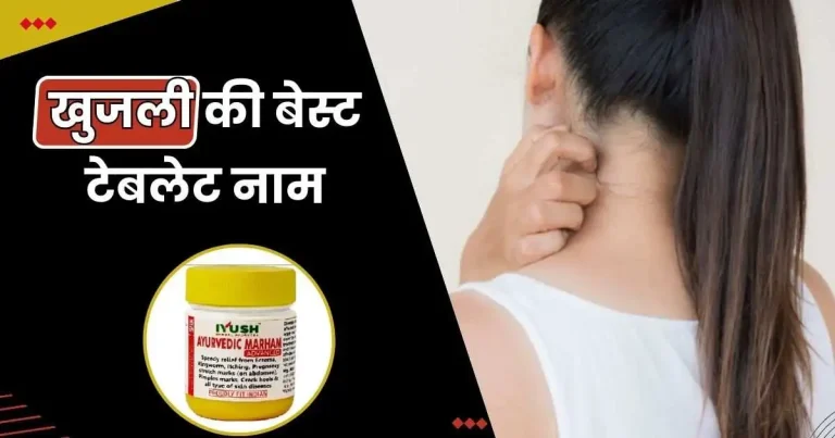 खुजली की बेस्ट टेबलेट नाम